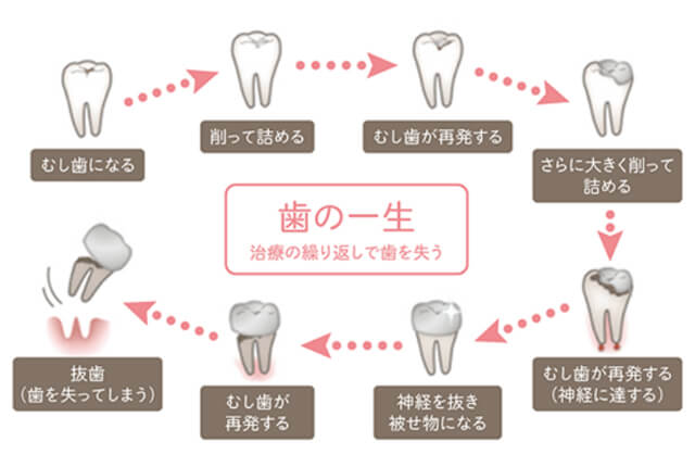 歯の一生